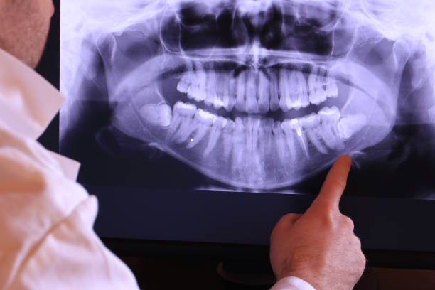 Best Pediatric Emergency Dentist in Orangetree, FL
