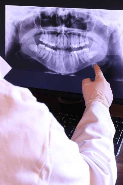 Best Emergency Dentist for Lost Fillings or Crowns in Orangetree, FL