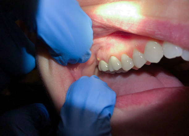 Best Emergency Cosmetic Dentistry in Orangetree, FL